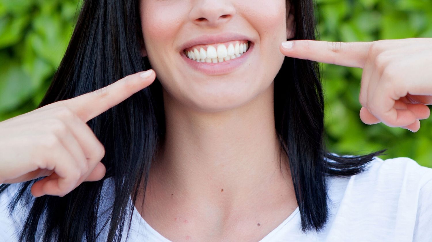 oferta blanqueamiento dental Ibiza